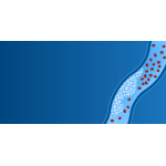 PAD and Revascularization