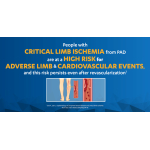 PAD and Critical Limb Ischemia